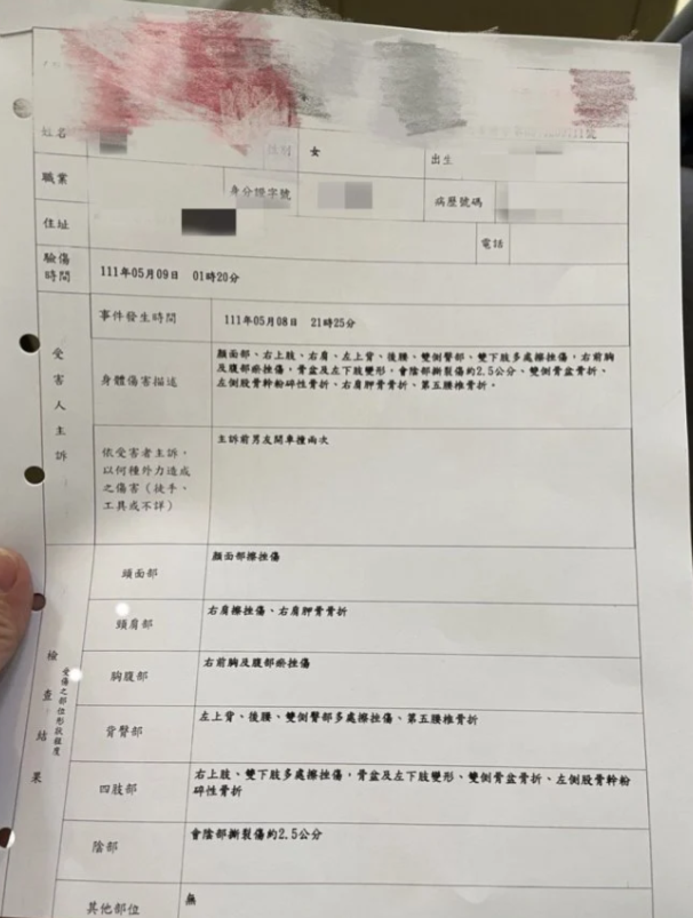 女方姐姐貼出妹妹的驗傷單。（翻攝自Dcard）