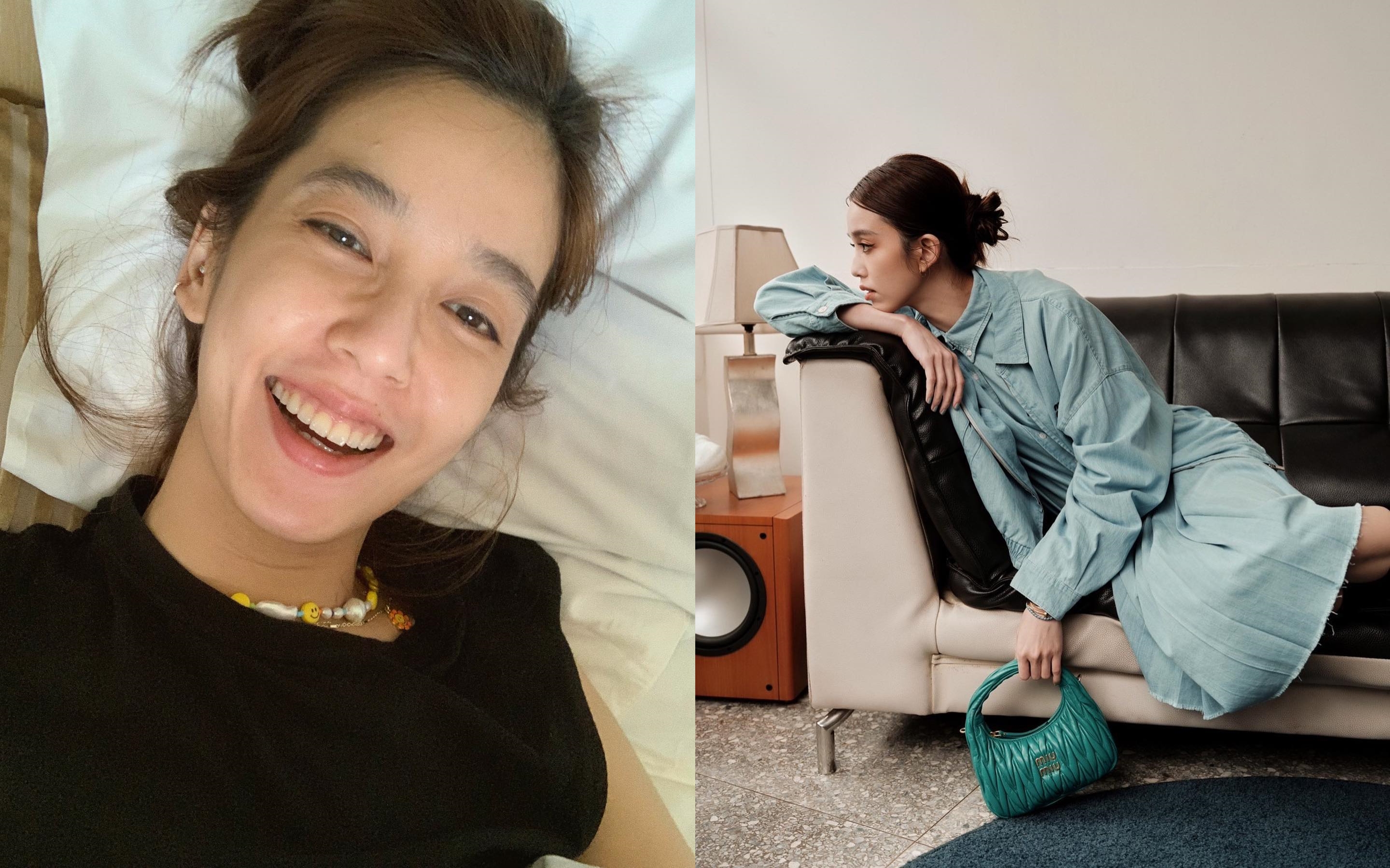 陳庭妮笑露美齒，是8年來矯正的成果。（翻攝自陳庭妮臉書）