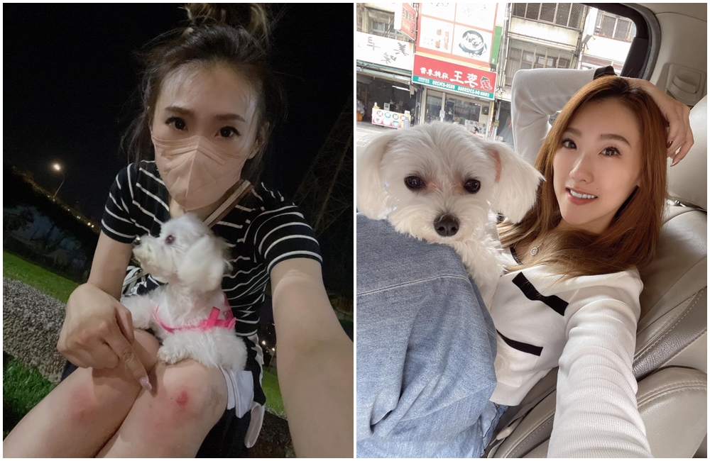 謝金晶遭受野狗攻擊，為了保護愛犬而受傷。（翻攝自謝金晶臉書）