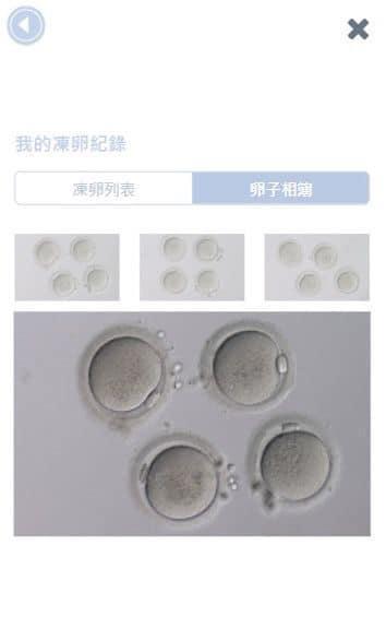 謝盈萱從自己的凍卵APP可以窺見自己的卵子動態。（翻攝謝盈萱臉書）