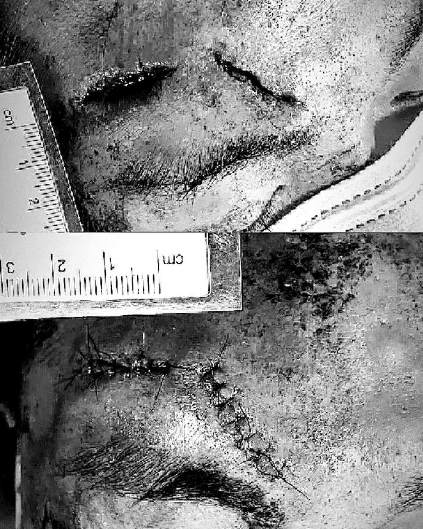 醫師黃京葦貼出警世照,呼籲大家不要玩命,減速慢行、酒後不要騎車、要戴安全帽。(翻攝自嶼上急醫黃京葦臉書)