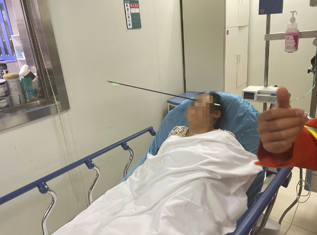 中國西安一名婦人在社區散步，突然被箭射穿左眼下方臉皮送醫。（翻攝搜狐新聞）