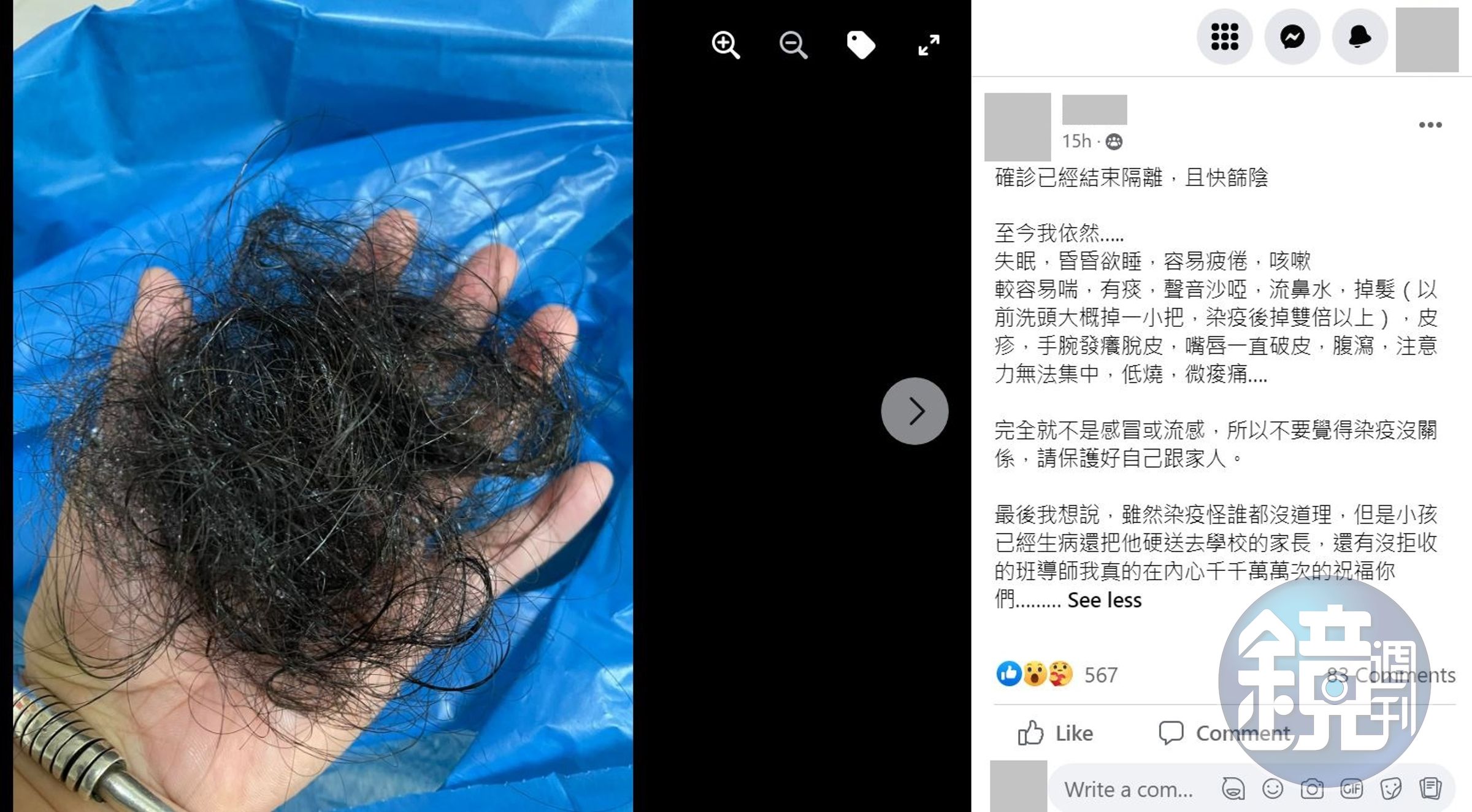 女網友在社團PO文，貼出1日的驚人掉髮量。（翻攝爆怨公社臉書）