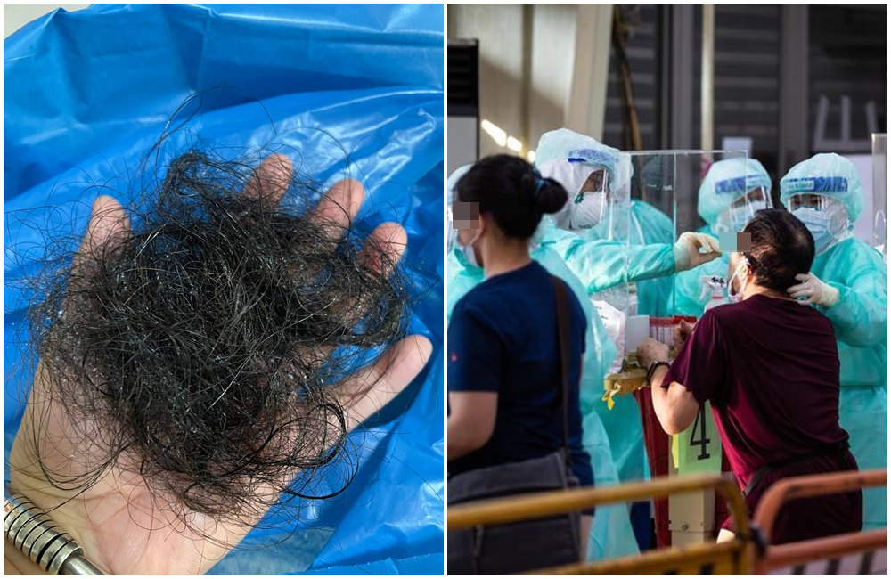 確診民眾貼出自己的掉髮量（左圖），令人心疼。（翻攝爆怨公社／本刊資料照）