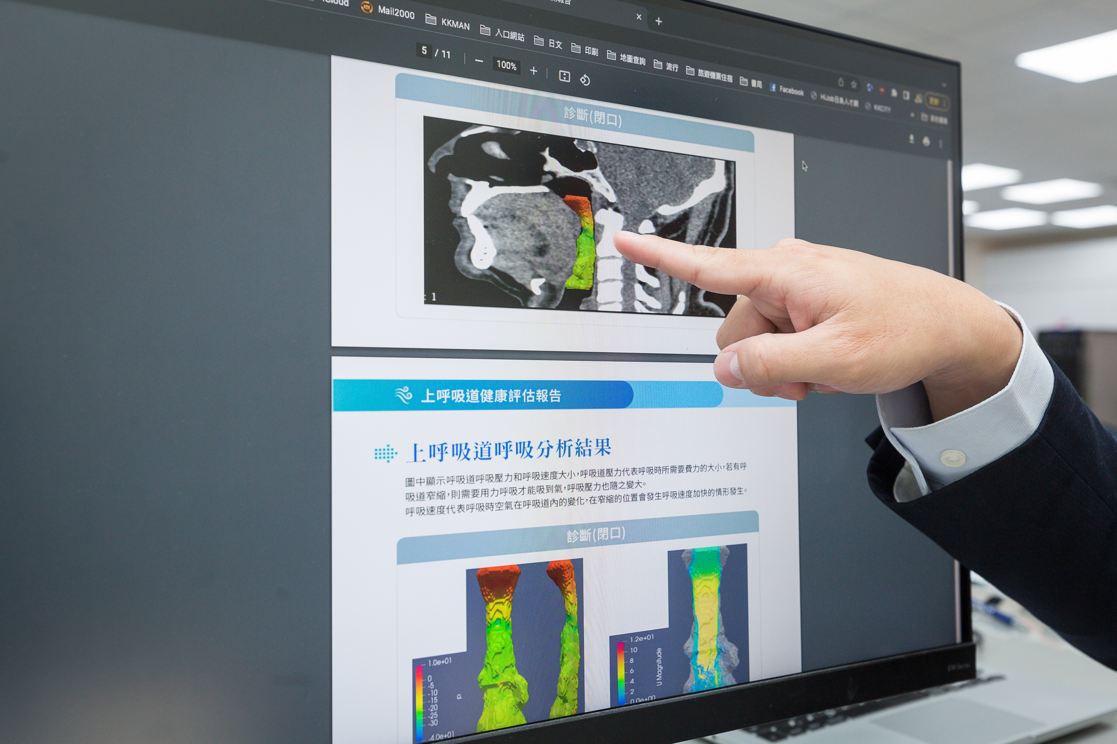 太暘科技是全球第一家將流體力學、雲端運算和影像分析，運用在睡眠呼吸診斷和治療的生技公司。