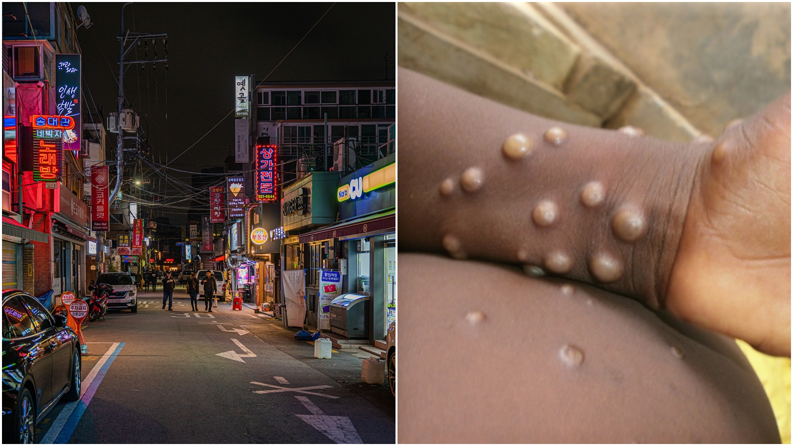 猴痘確定入侵新加坡與南韓，南韓稍早證實1名自德國入境的南韓人確診猴痘。（pexels／攝影師：Ethan Brooke、翻攝自WHO官網）