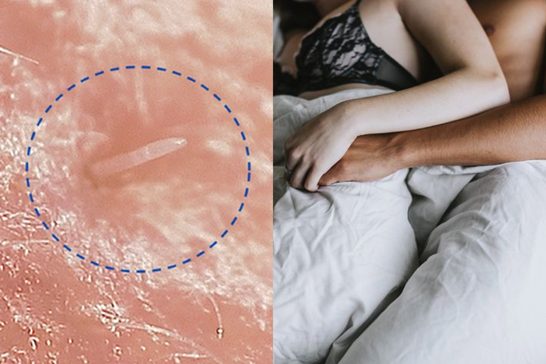 科學家觀察「顏射」！這蟲蟲在你臉上瘋狂做愛生小孩，洗臉也沒用。（翻自《BBC》+menshealth.com）