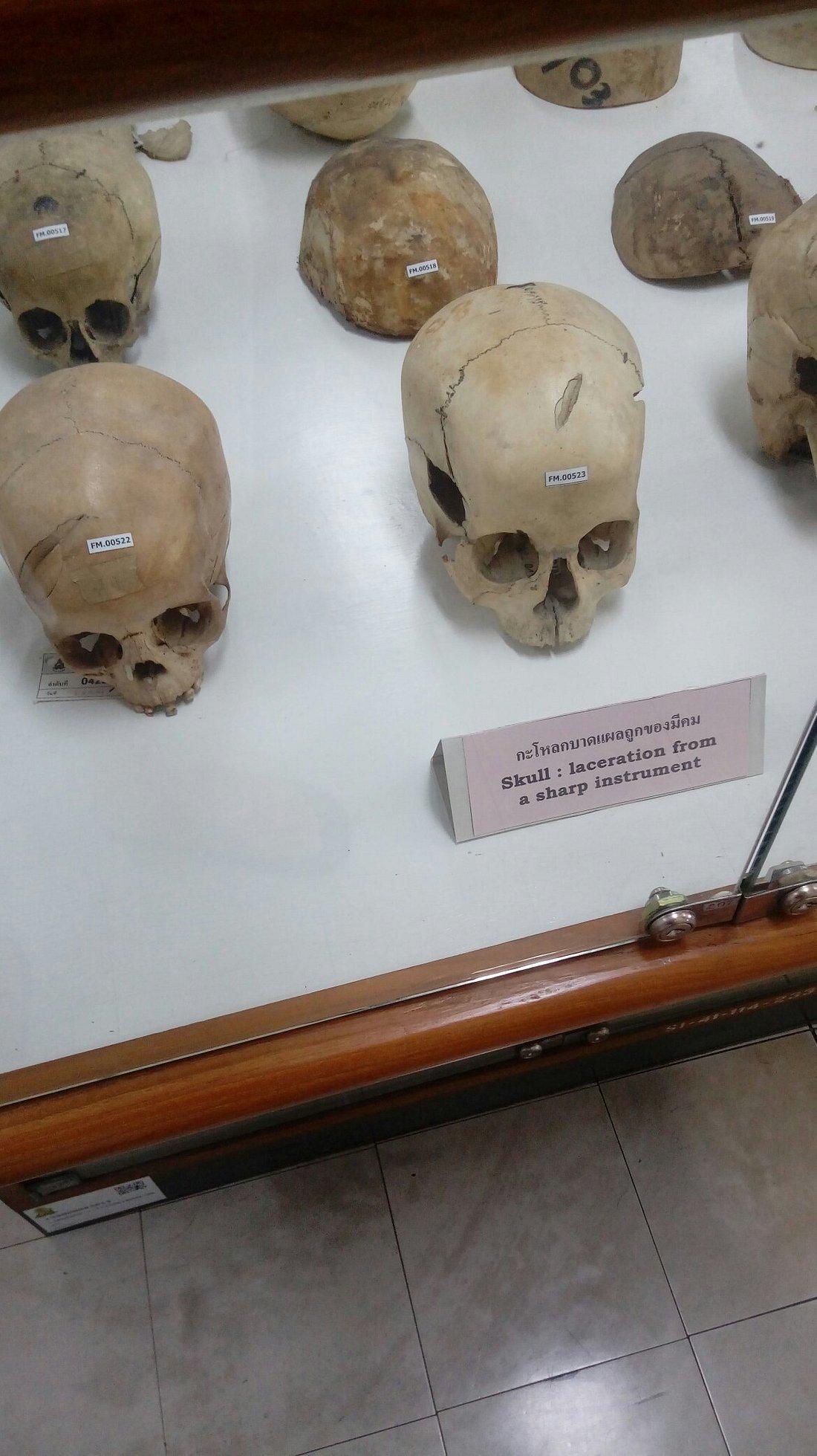 這些都是真遺體。(翻自th.tripadvisor.com)