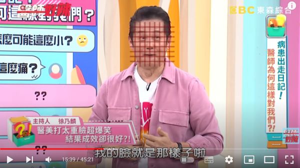 徐乃麟多年前打完電波拉皮,臉上留下類似烤肉網的痕跡。(翻攝自YouTube醫師好辣)