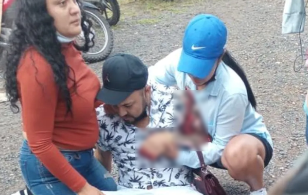 白目男硬闖禁區自拍,手臂被獅子王咬爛影片曝光!園方讚「辛巴很乖的」。(翻自《Hondudiario》)
