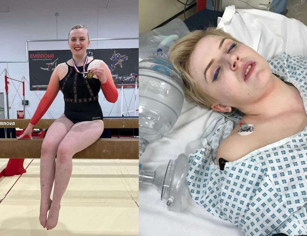 英國一名體操運動員柯特斯(Natasha Coates)患罕見疾病,只要情緒太過激動都可能要她命。(翻攝IG @natashacoatesgb)