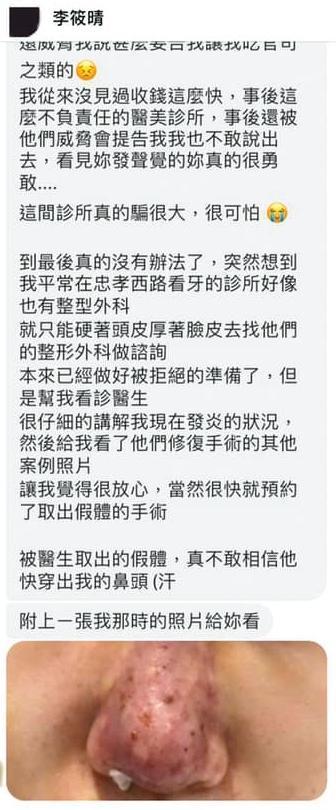 有網友在莉亞粉絲專頁留言說在元和雅整形失敗,結果被檢警查出是莉亞辦假帳號自導自演。照片則是來路不明。(翻攝Lia 莉亞臉書)