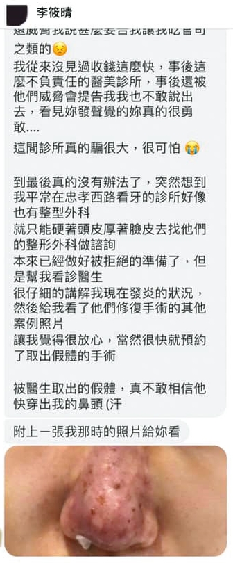 有網友在莉亞粉絲專頁留言說在元和雅整形失敗,結果被檢警查出是莉亞辦假帳號自導自演。照片則是來路不明。(翻攝Lia 莉亞臉書)