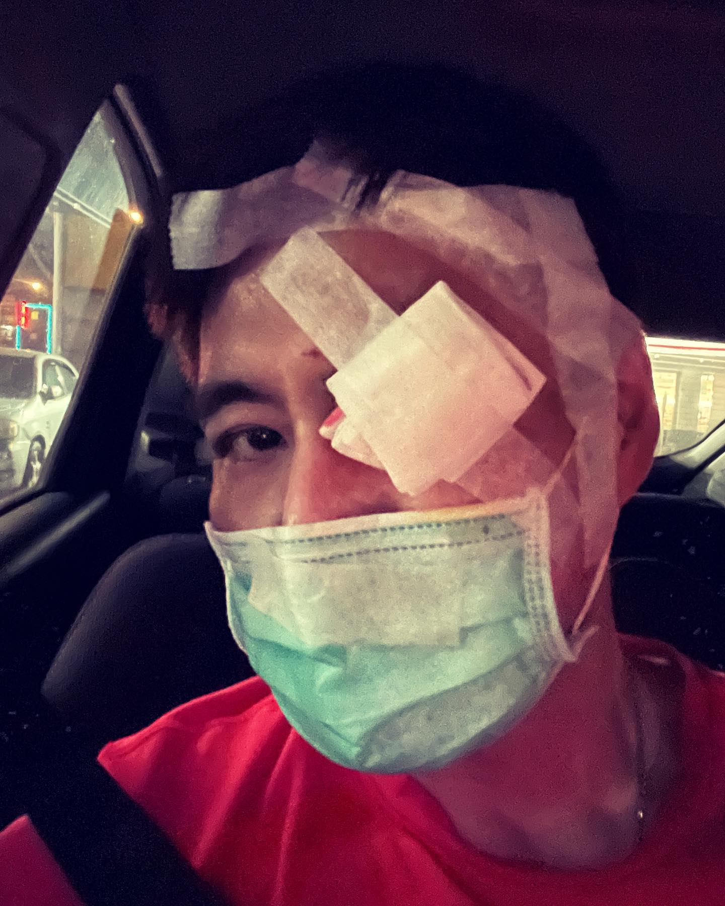 劉至翰只是割針眼，但被包紮的好大陣仗。（翻攝自劉至翰 Johnny Liu臉書）