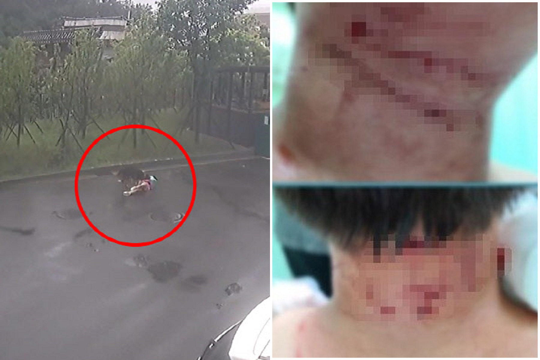 大型犬被飼主放任死咬男童頸部，大媽路過見死不救！驚駭影片曝光。（翻自《NEWS 1》）