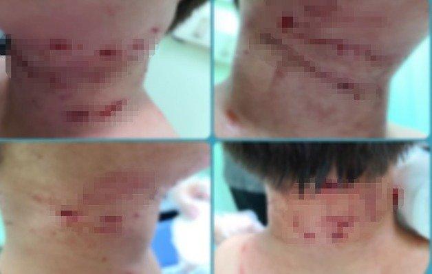 男童的傷勢集中在頸部。（翻自《NEWS 1》）