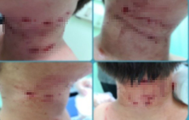 男童的傷勢集中在頸部。（翻自《NEWS 1》）