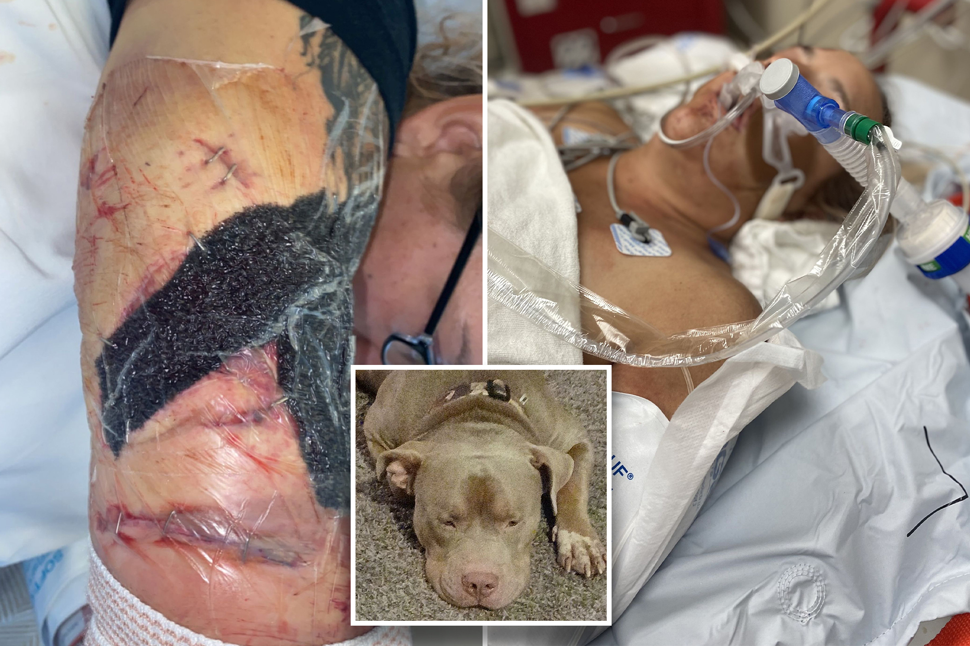 人妻收養受虐比特犬，愛到和牠上床睡！竟遭狠咬生吃滿屋濺血。（翻自《紐約郵報》）