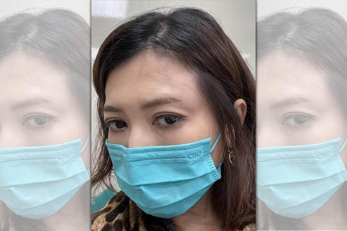 廖家儀返台拍《市井豪門》,意外碰上車禍,所幸只有頭部紅腫,觀察有無腦震盪。