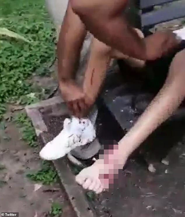 約瑟的腳被美洲豹咬傷，腿部也有被抓傷的痕跡。（翻自《每日郵報》）
