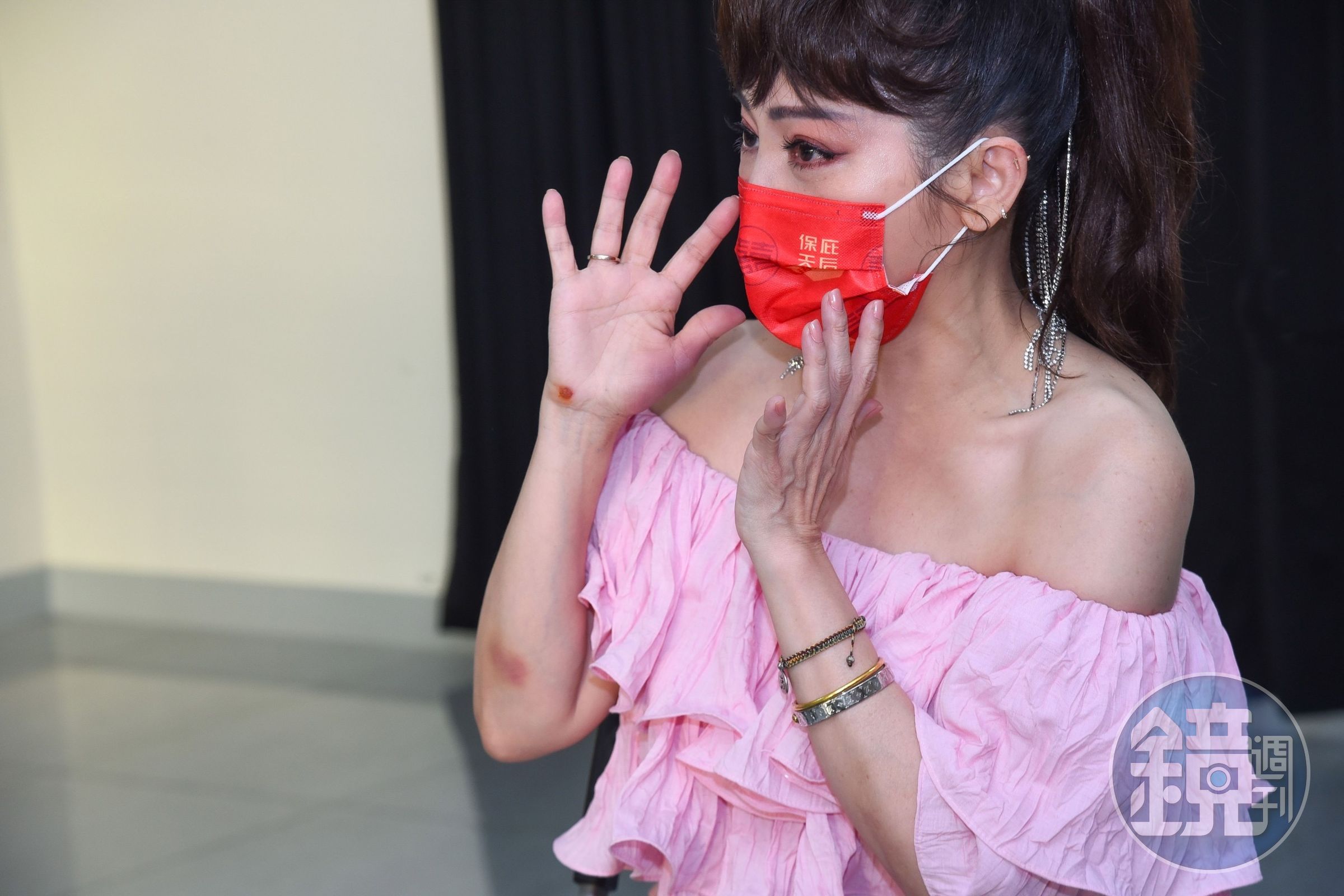 王彩樺前兩天不小心滑倒摔傷，滿手的傷痕不影響演出。（高雄流行音樂中心提供）