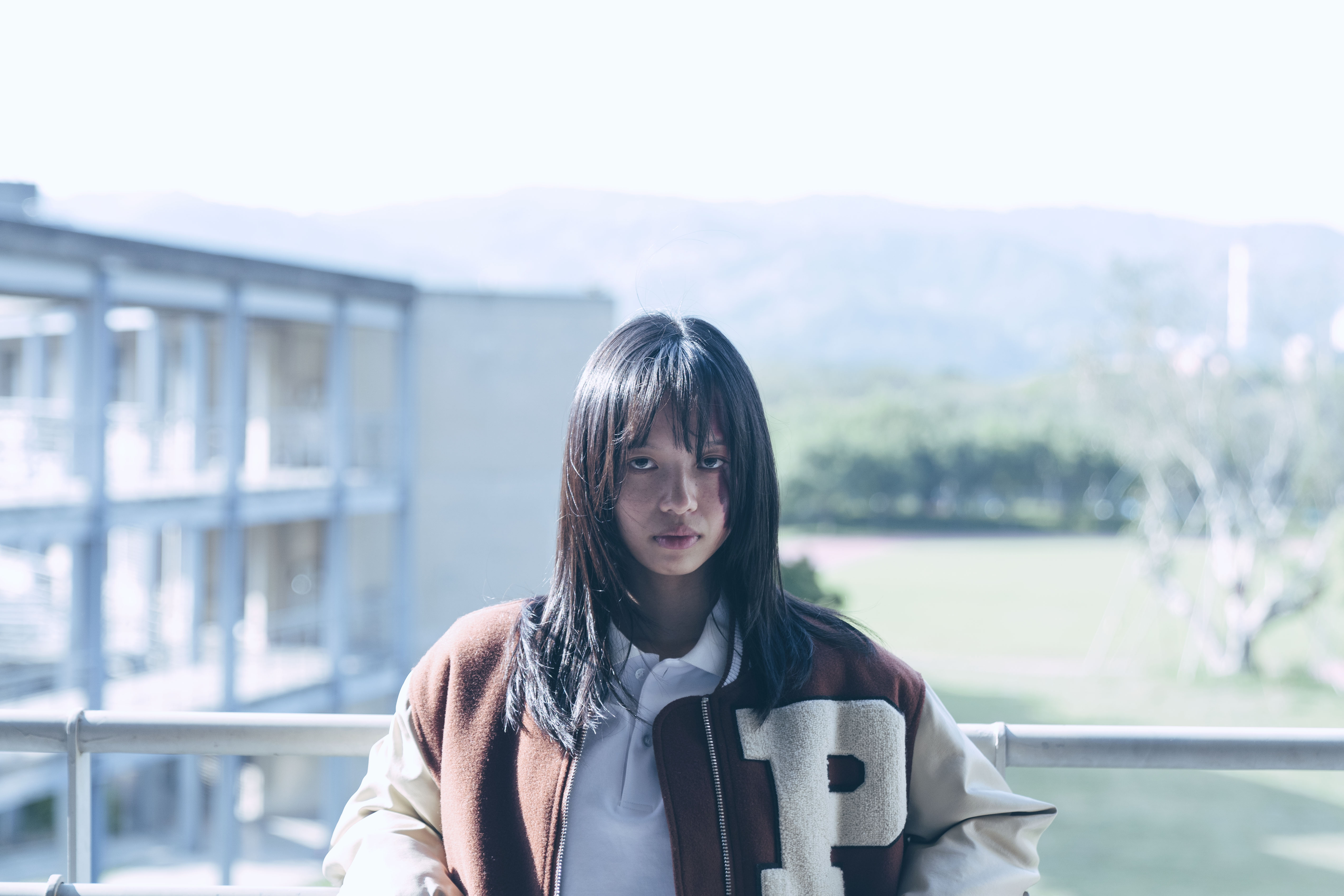 王渝屏在《我願意》臉上有紅色胎記，被同學認為怪物。（絡思本娛樂製作提供）