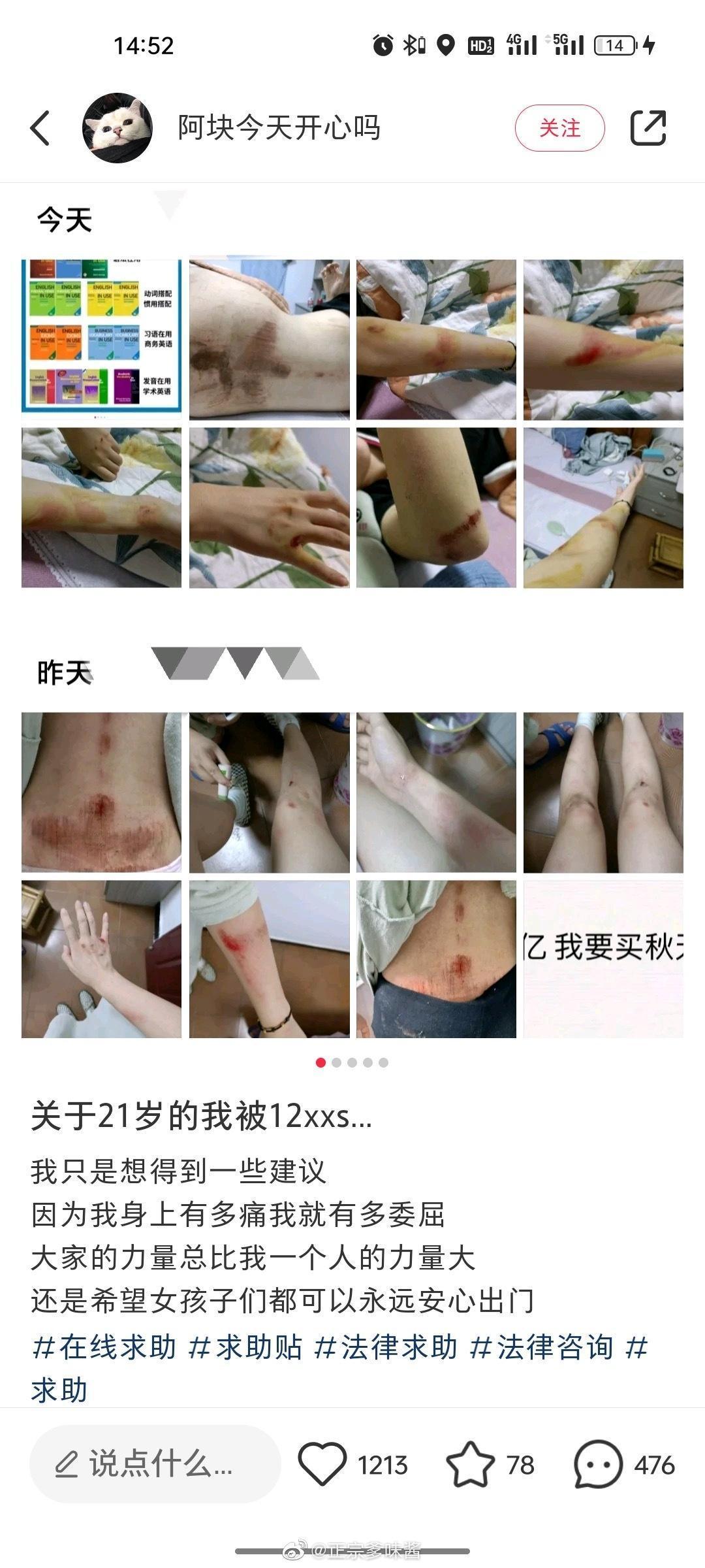 女網友曝光傷勢,怵目驚心。(翻自微博)
