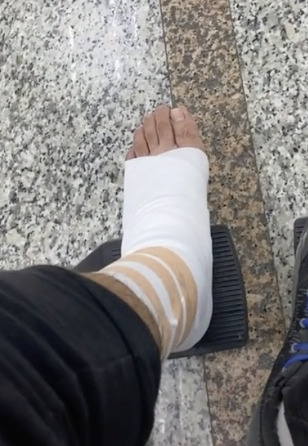 作者最後拍向自己的腳踝，喊了一句「我腳踝很痛」，讓大批網已笑翻。（翻攝TikTok）