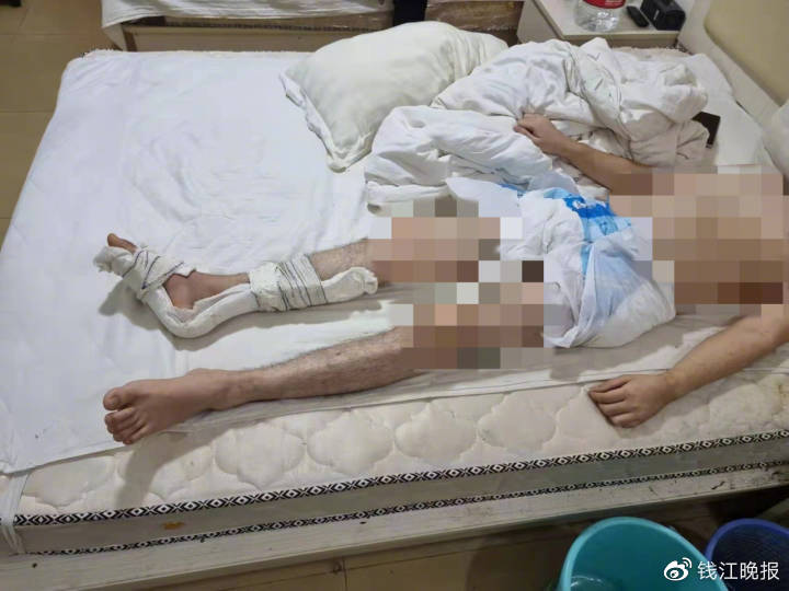中國受害者被救出,但身體已經被弄殘。(翻自微博)