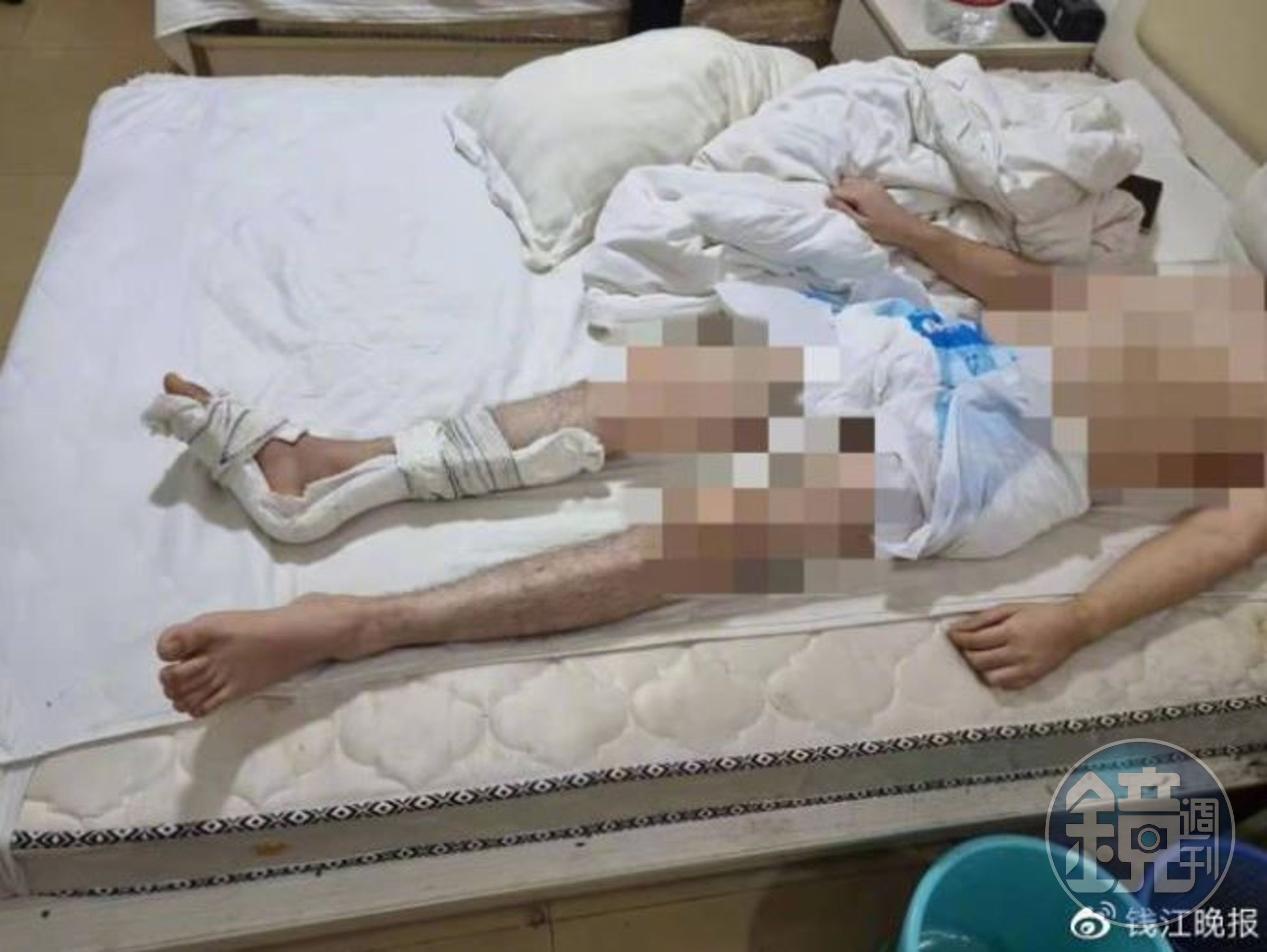 今年年初爆發的「血奴案」，中國受害者被救出，但身體已經被弄殘。（翻攝微博）