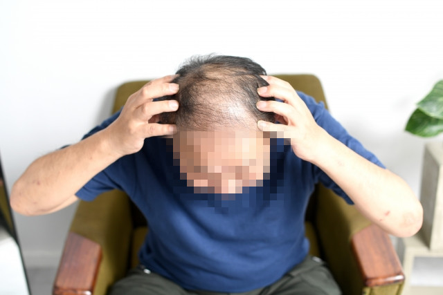 一名科技男提問，買房跟植髮該選哪一個？熱心網友紛紛給建議。（示意圖／photo AC）