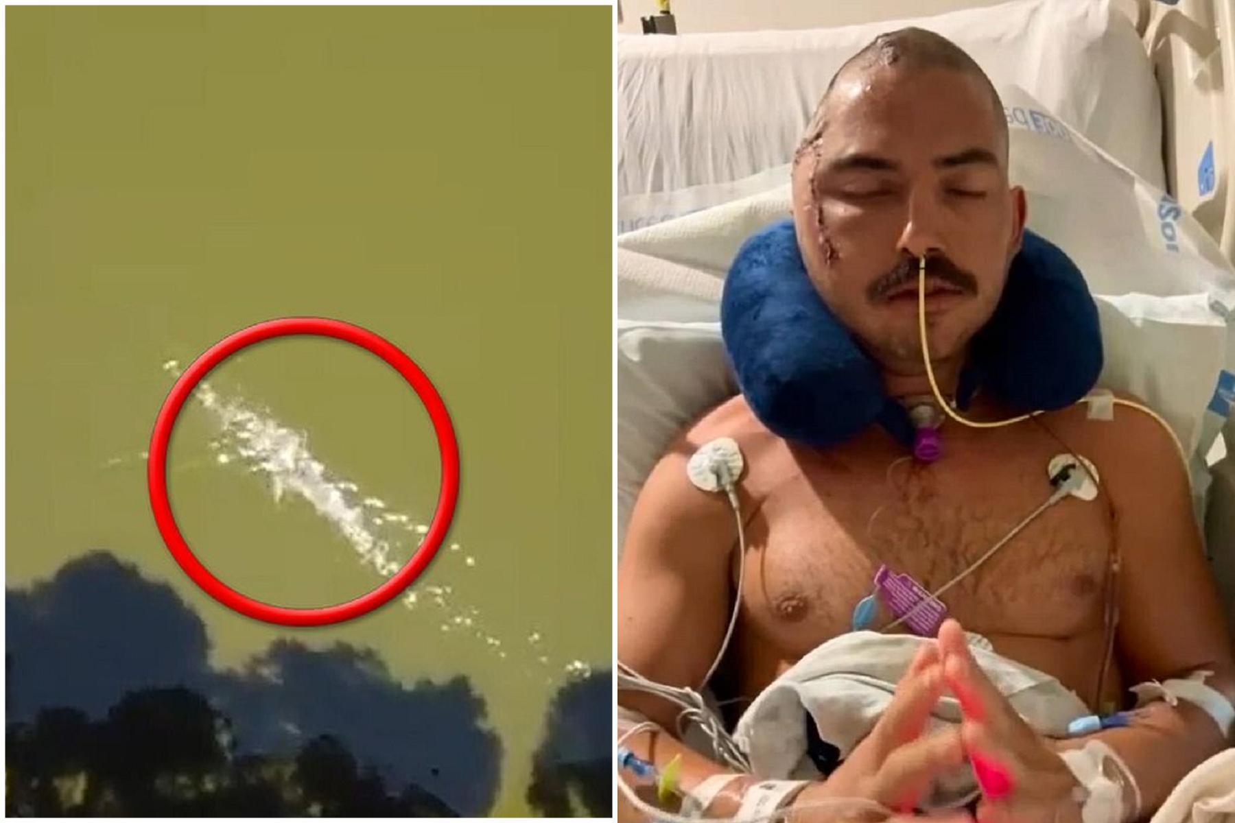 消防員遭鱷魚攻擊直接吞，右半頭骨不見！驚悚影像曝光。（翻自《每日郵報》）