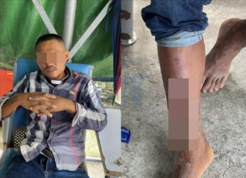  33歲林姓男子至柬埔寨工作，抵達當地後遭人凌虐，被台商發現時已全身傷痕累累、小腿已被利刃挖除一塊肉躺在路邊。（翻攝畫面）