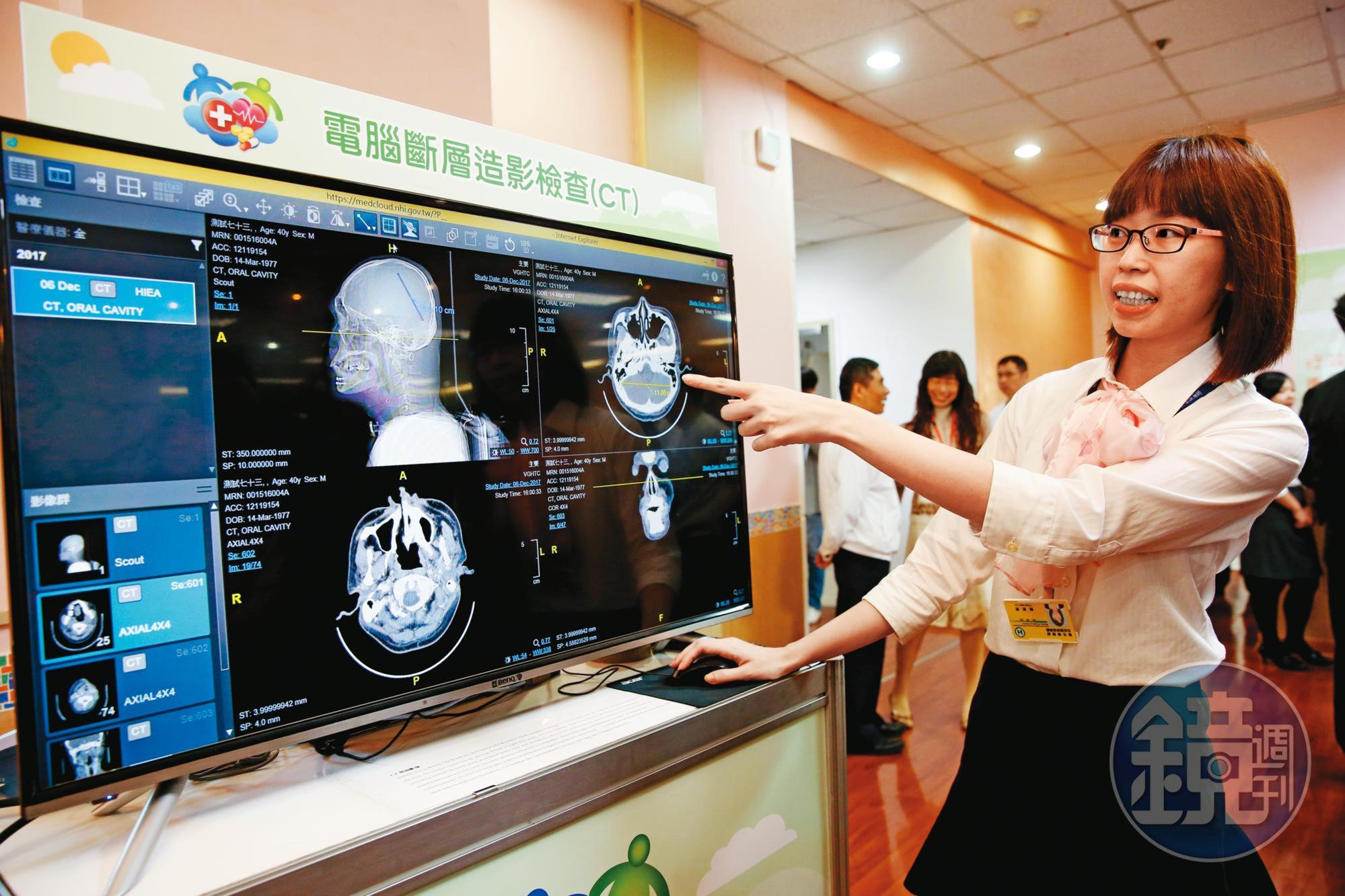 專家指出,早覺醫療並非完全得結合AI,但無論硬體或AI軟體,唯有取得醫材證明才能真正打開市場。