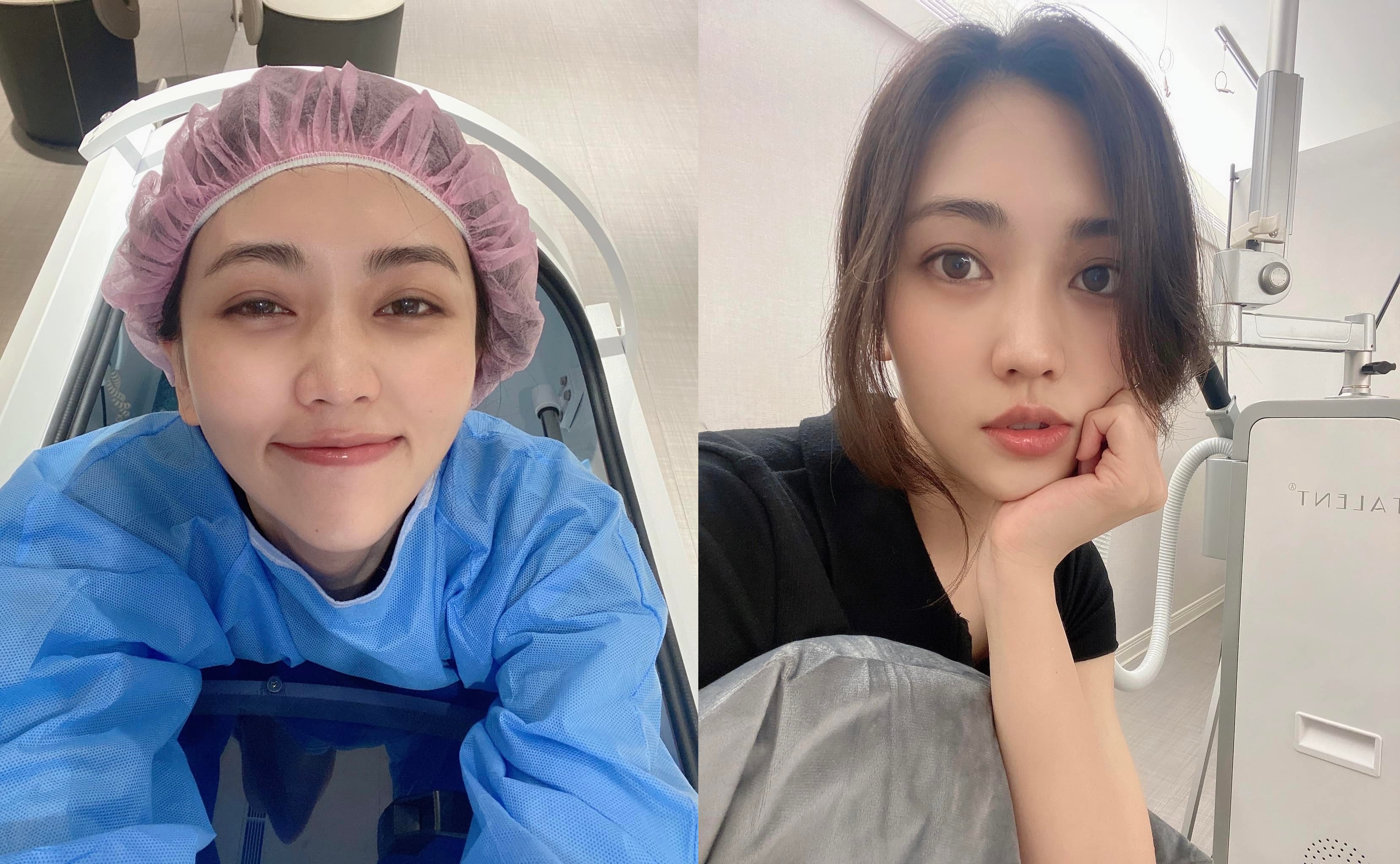 瑭霏行車時竟遇強盜，好在傷勢並無大礙。（翻攝瑭霏臉書）