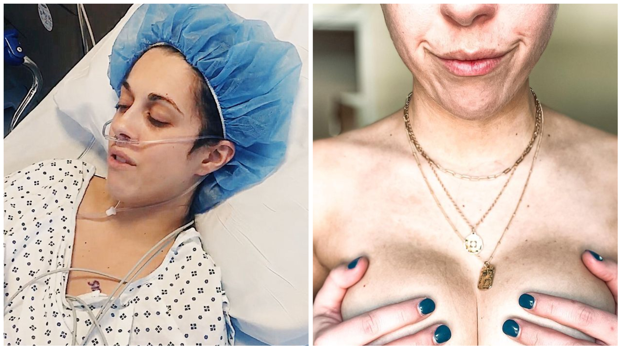 乳癌患者Dani Trops進行乳房切除手術後康復，投身乳癌防治宣導。（翻攝自IG @dani_trops）