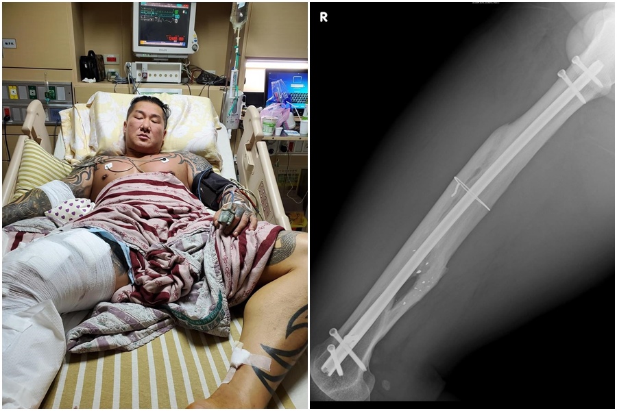 館長中彈滿2年，他透露雖然腳天天都會痛，但還是堅持訓練。（翻攝自飆捍臉書）