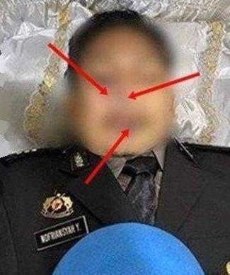 胡塔巴特臉上有多處瘀青,不只有槍傷,生前疑遭凌虐。(翻自portalyogya.com)