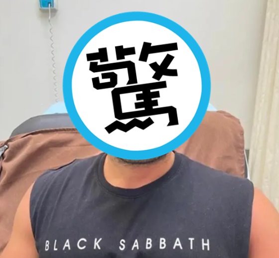 男子海邊度假回家竟發現「頭部腫脹」，嚇得趕緊前往醫院求助！（圖片翻攝自ladbible）