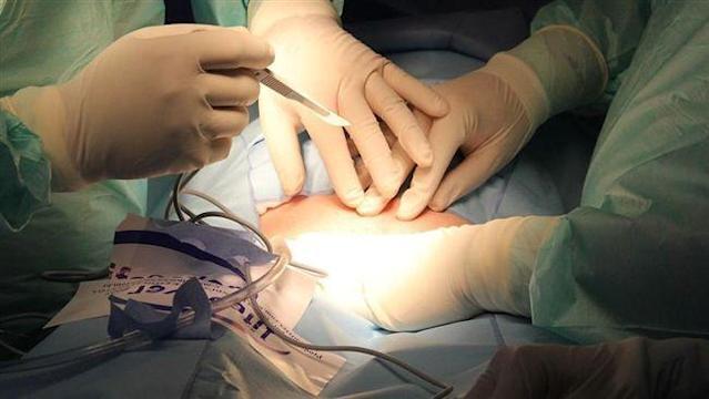一名人妻日前腹痛就醫,才知道自己被枕邊人偷偷賣腎,示意圖。(翻攝自pixabay)
