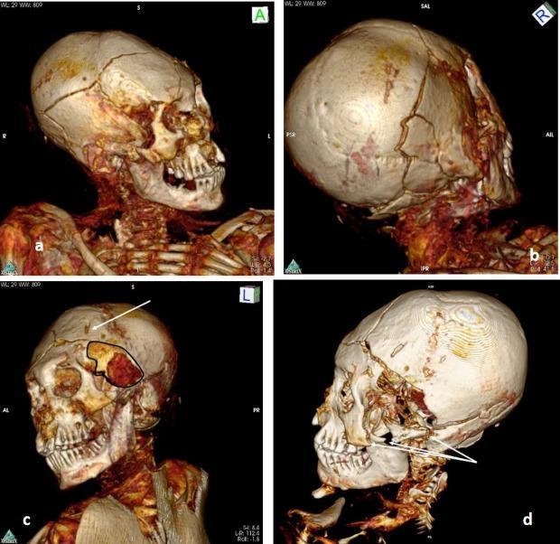 發現其中兩具男屍死得很慘。(翻自英國《太陽報》)