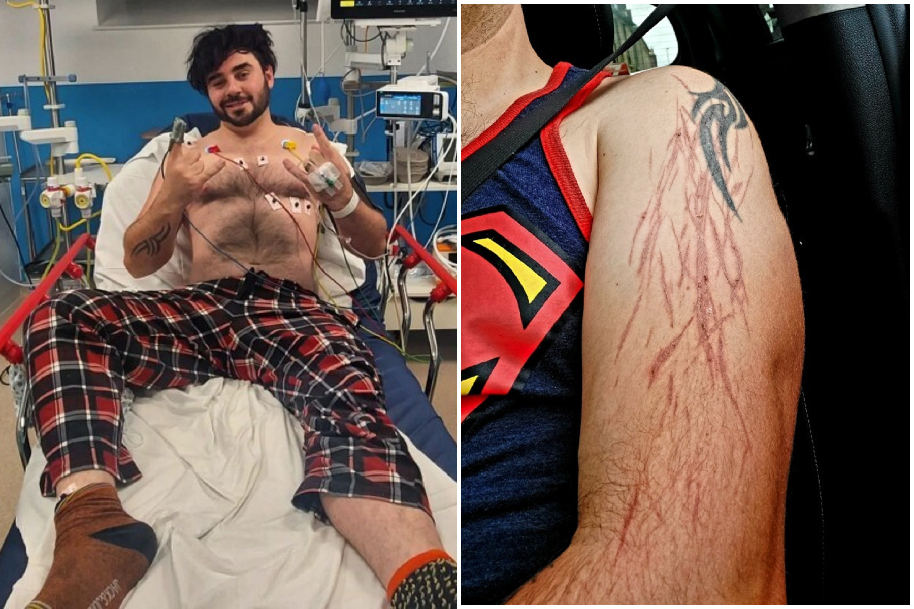 他在家打PS5電玩，慘遭「天打雷劈」肉體燒焦！大難不死後中樂透。（翻自《太陽報》）