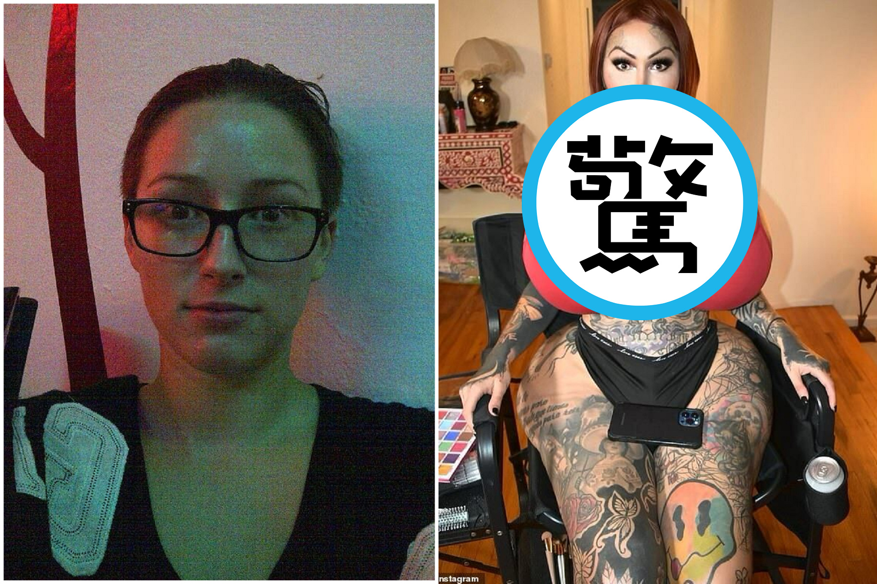 清秀女整出10公斤「巨彈奶」擁最肥大陰道，真的壞掉了！變殘廢痛不欲生。（翻自IG）