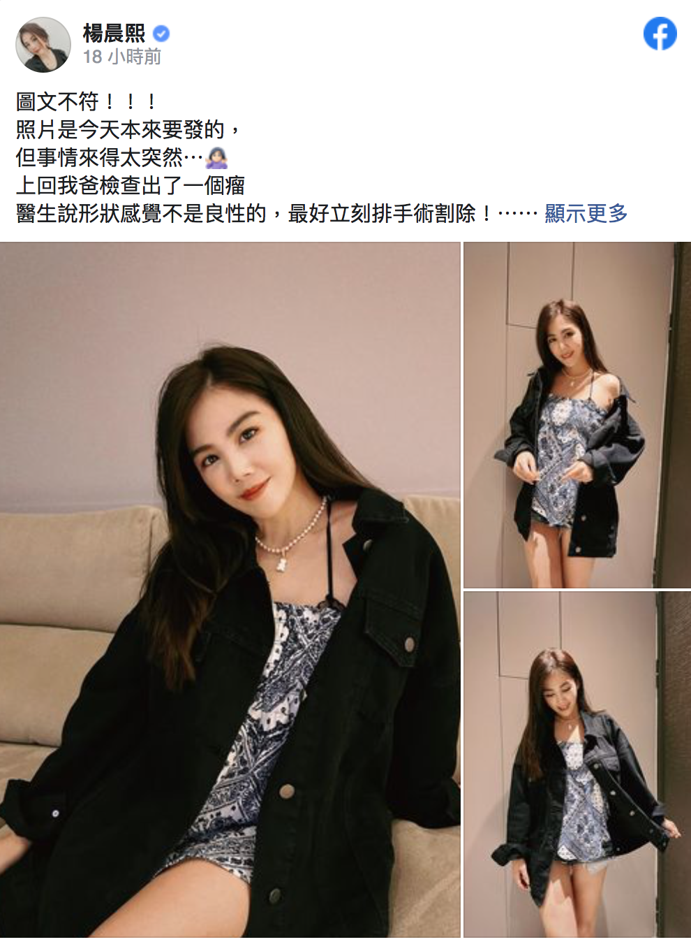 父親突接獲開刀通知，楊晨熙接到通知立即奔赴醫院。（翻攝自楊晨熙臉書）