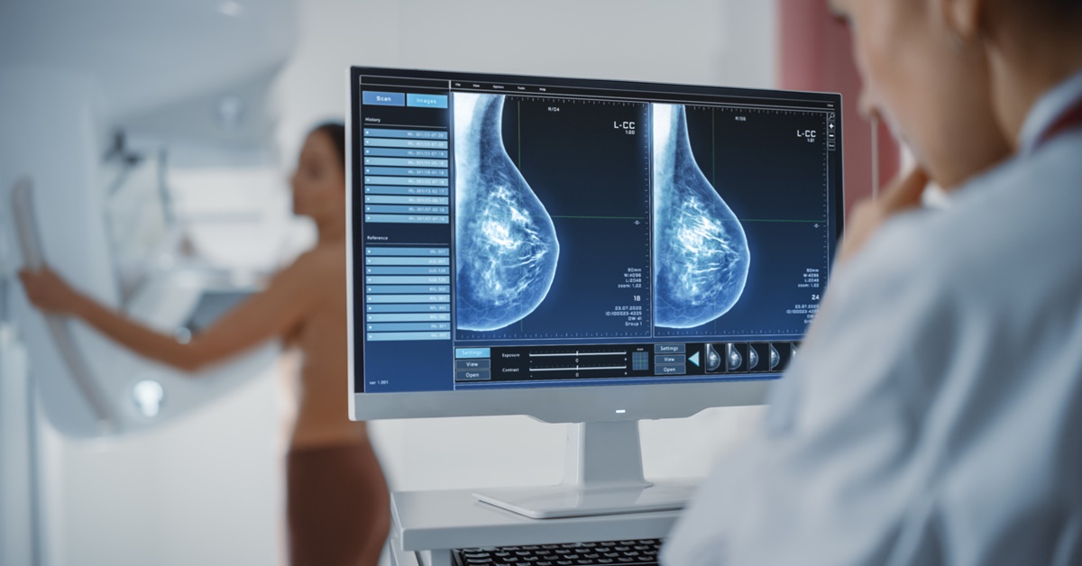 定期乳房X光攝影檢查，有助於降低乳癌死亡風險