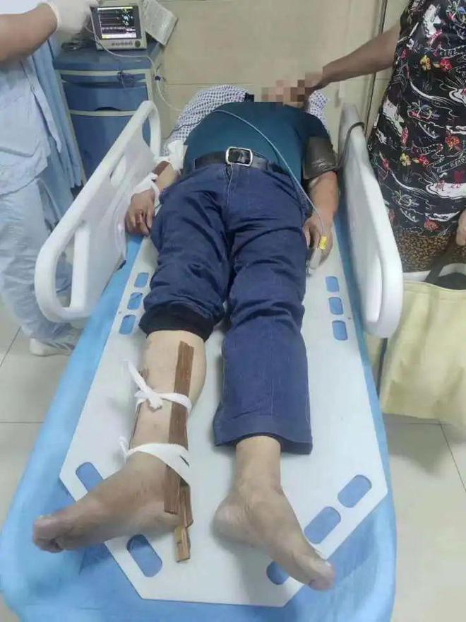 老翁手腳骨折。（翻攝自網易新聞）