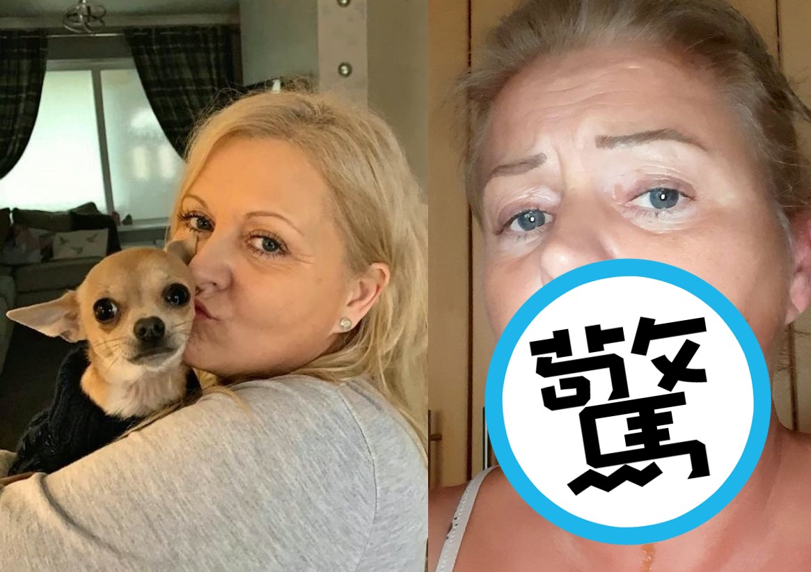 阿曼達日前和愛犬一同午睡，沒想到卻因為一個意外插曲，導致她住院治療3天。（翻攝自dailystar）