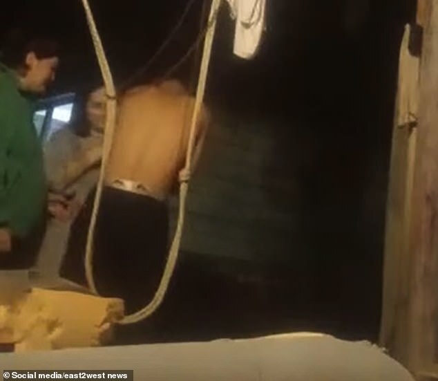 男子在家人的支持下斷手臂。(翻自《每日郵報》)