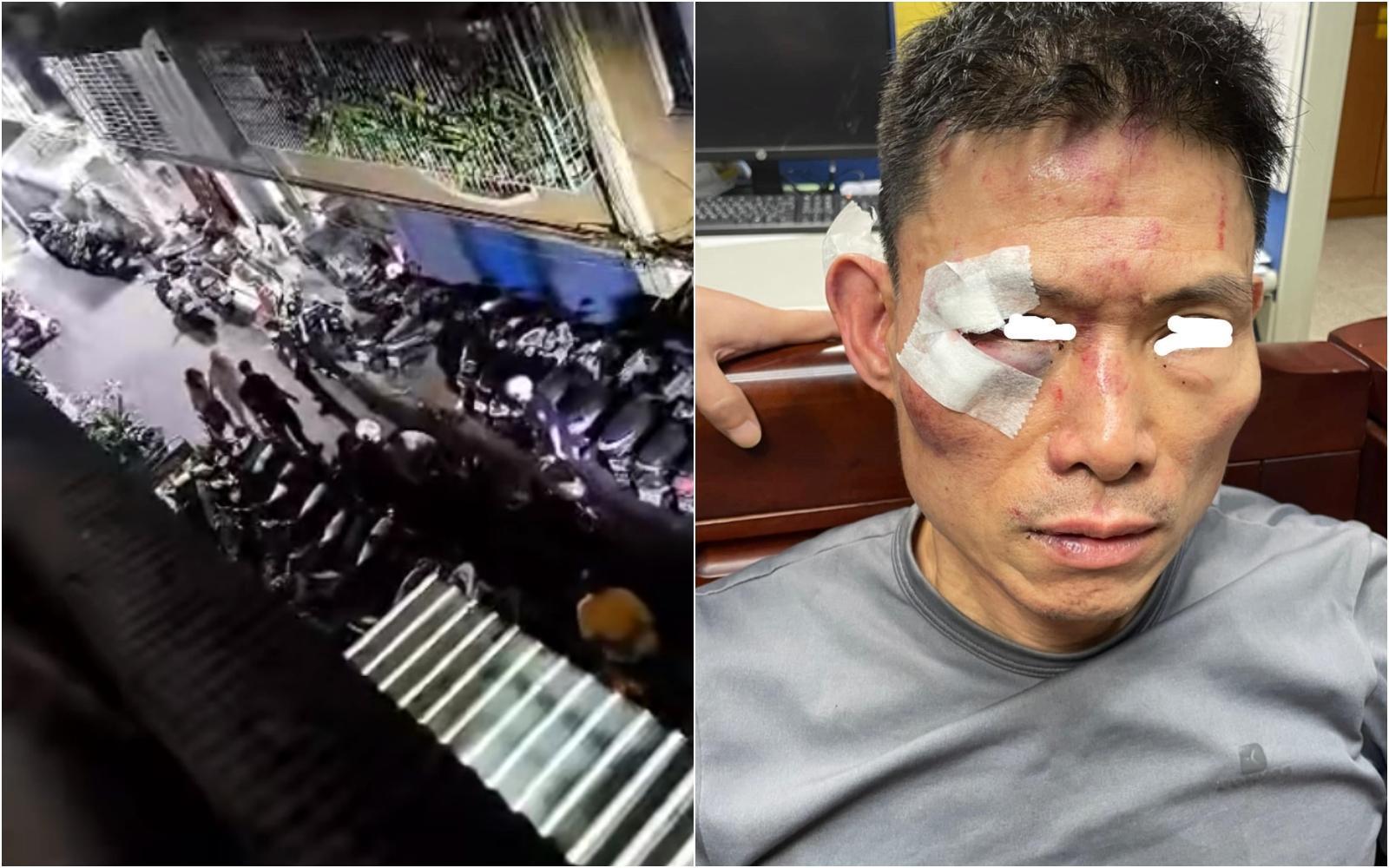 黃男遭誤認成通緝犯被暴打一頓，事後竟還被員警提告傷害。（翻攝臉書）