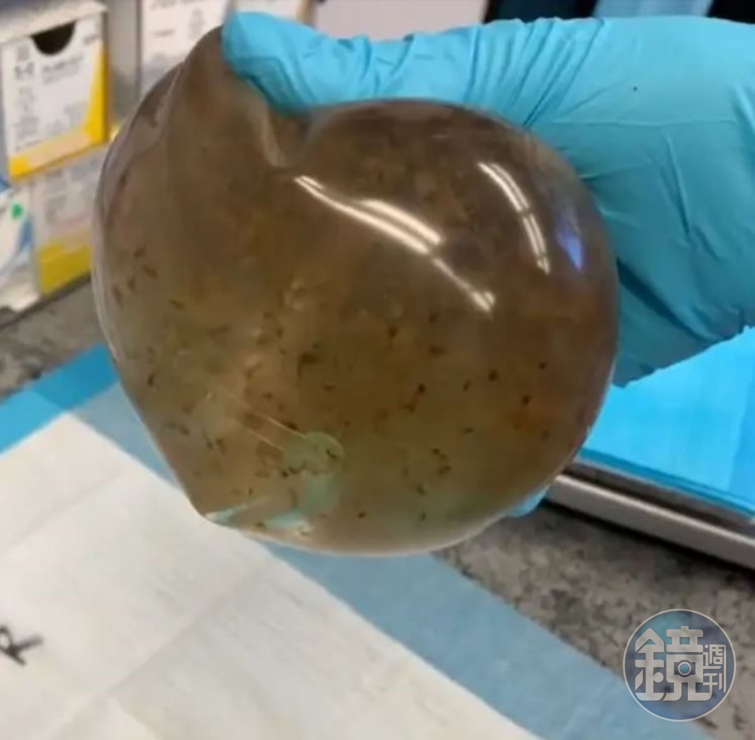 梅麗莎呼籲大家要注意隆乳所帶來的危險與後遺症。（翻攝IG melisssssalima）
